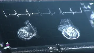 Thumbnail: Revere Health Cardiology