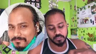 Thumbnail: “Hair Regrowth Mask 😱 Bald to Thick Hair | Before & After Results”