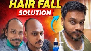 Thumbnail: Baldness to Hair Growth Journey | Hair Fall Solution That Works