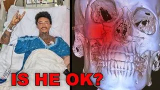 Thumbnail: Nyjah's New Skull Fracture Has Me Worried...