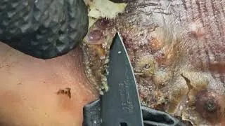 Thumbnail: James Ngota's jigger digging - see long video @ riseupsociety.net & ruskenya.org