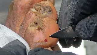 Thumbnail: Amos' jiggers - see long vid @ riseupsociety.net & ruskenya.org