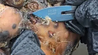 Thumbnail: Lazarus Josephat - rather dead than jiggers - see long vids @ riseupsociety.net & ruskenya.org