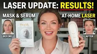 Thumbnail: I Used the MimiSilk Iris for 6 Months: Here's What Happened