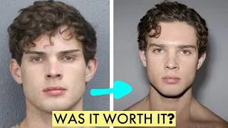 Thumbnail: How Attractive Is Clavicular Now?