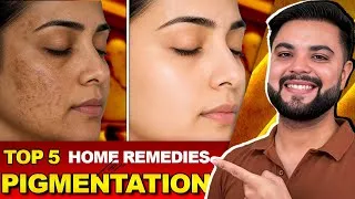 Thumbnail: Top 5 Home Remedies for Pigmentation That Actually Work | Dark Spots & Melasma Treatment 