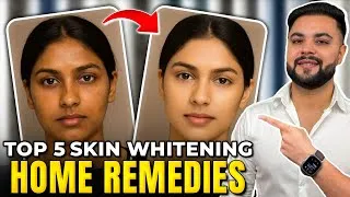 Thumbnail: Top 5 Skin Whitening Home Remedies: Best Skin Brightening & Tan Removal Treatment 