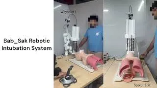 Thumbnail: Robotic Intubtation System