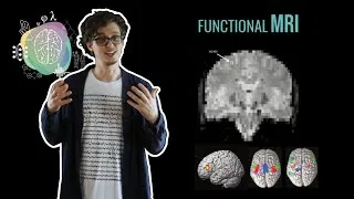 Thumbnail: Visualizing the brain - functional neuroimaging