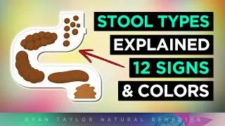 Thumbnail: 12 Poop Shapes & Colors (And What They Mean)
