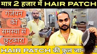 Thumbnail: Hair Patch ₹2000 में । 1 पीस भी घर बैठे मंगाए | Hair Patch Wholesale Market Delhi | Hair Wig for Men