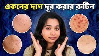 Thumbnail: 🟠 একনে ও একনের দাগ দূর করার স্কিনকেয়ার রুটিন (রেটিনল ব্যবহারের নির্দেশনাসহ)