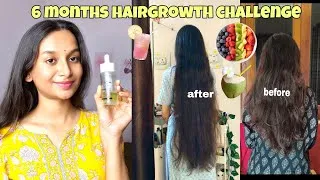 Thumbnail: 6 months hairgrowth challenge with glad I met you hairgrowth serum 🌸✨#hairgrowth #haircare 