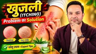 Thumbnail: 👉 Khujli (ITCHING) Hoti Kyun Hai? 🤔 Solution Is Video Mein!