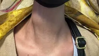 Thumbnail: A Neck Mass and 4 Questions