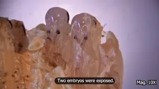 Thumbnail: Rotten Cockroach Eggs Under the Microscope