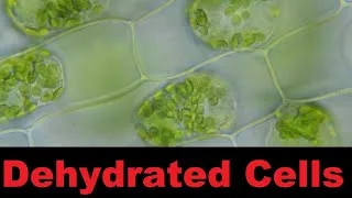 Thumbnail: Plasmolysis and Crenation Under the Microscope