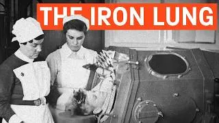 Thumbnail: Surviving Polio | The History of the Iron Lung | Here’s the Thing