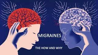 Thumbnail: The Science Behind Migraines:  Scientific Animations Explains the hows and whys of migraines.
