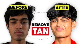 Thumbnail: How I Removed Face Tan at Home FULL DETAN GUIDE