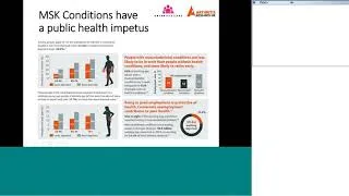 Thumbnail: Arthritis and Swimming webinar July 2018