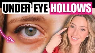 Thumbnail: How to Get Rid of Sunken, Hollow Under Eyes — What Actually Helps from a Dermatologist | Dr. Idriss