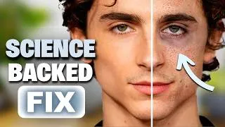 Thumbnail: Fix Your Eye Bags & Dark Circles Forever! (Using Science)