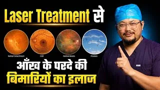 Thumbnail: Retina Laser कब जरूरी है? Retinal Tear, Detachment, Floaters & CSR