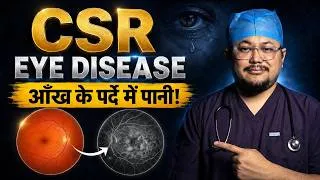 Thumbnail: STRESS की वजह से आँख के पर्दे में सूजन l CSR : Central Serous Retinopathy