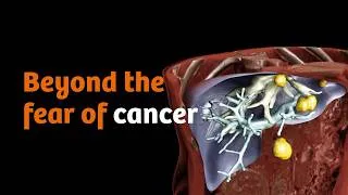 Thumbnail: Bernd Montag on cancer care