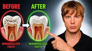 Thumbnail: The Viral Toothpaste That Remineralizes Your Teeth