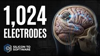 Thumbnail: Neuralink Brain Chip: How the Hardware Actually Works