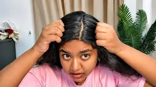 Thumbnail: 🚀 മുടി കൊഴിച്ചിൽ മാറി മുടി വളരാൻ ഈ Serum മതി! Best Hair Growth Serum 💯