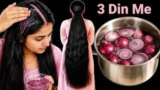 Thumbnail: Use This Onion Remedy For Stop Hair Fall & Get Super Fast Thicker Long Shiny Hair In Just 3 Days 💥🔥