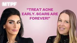Thumbnail: Hormonal Acne, Hair Loss & Lasers: The Truth You Need
