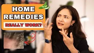 Thumbnail: Seborrheic Dermatitis Home Remedies That Actually Work
