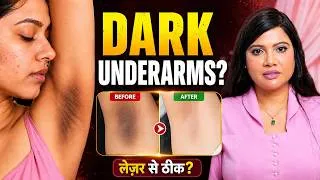 Thumbnail: Dark Underarms कैसे ठीक करें? | Laser Hair Reduction & Underarm Lightening Treatment
