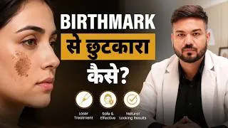 Thumbnail: Face पर Birthmark कैसे हटाएं? | Birthmark Removal Treatment | Laser Treatment | Skinlogics Clinic