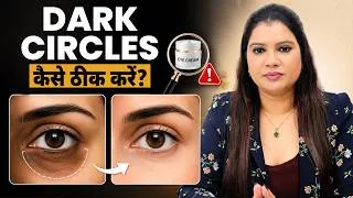 Thumbnail: Dark Circle कैसे हटाएं? सही Under Eye Cream कैसे चुनें | Dark Circles Treatment Guide