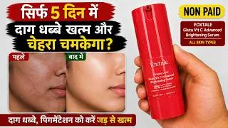 Thumbnail: Foxtale Gluta Vitamin C Serum | foxtale gluta vitamin c serum review | foxtale serum review