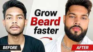 Thumbnail: Secret to Grow Your Beard Faster🤯