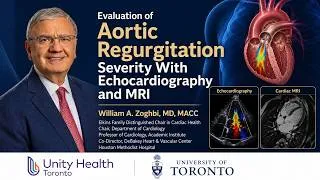 Thumbnail: Evaluation of Aortic Regurgitation Severity With Echocardiography and MRI