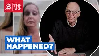 Thumbnail: Forensic expert analyses photographs of Virginia Giuffre's bruises