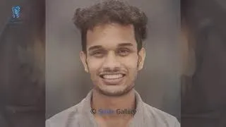 Thumbnail: Misaligned to Stunning Smile| Pankaj's Braces Journey | Patient Testimonial