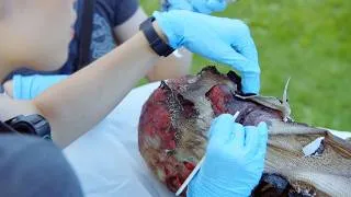 Thumbnail: The fabric melted onto his skin.