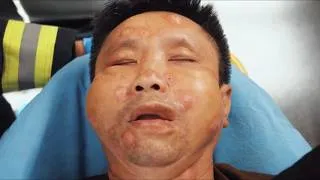 Thumbnail: A Swarm of Killer Bees Attacked Him.