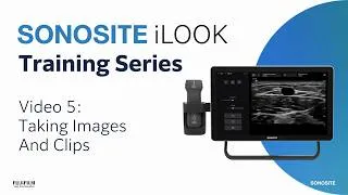Thumbnail: Sonosite iLOOK: Taking Images and Clips