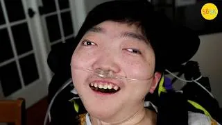 Thumbnail: He's Missing Most of His Brain But Surprised Everyone