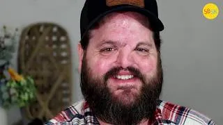 Thumbnail: Born Without a Nose and Rejected by His Parents (Now He's 50)