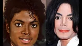 Thumbnail: Jason Adams explains Michael Jackson’s Rare skin disease ,lupus ,and hair burned